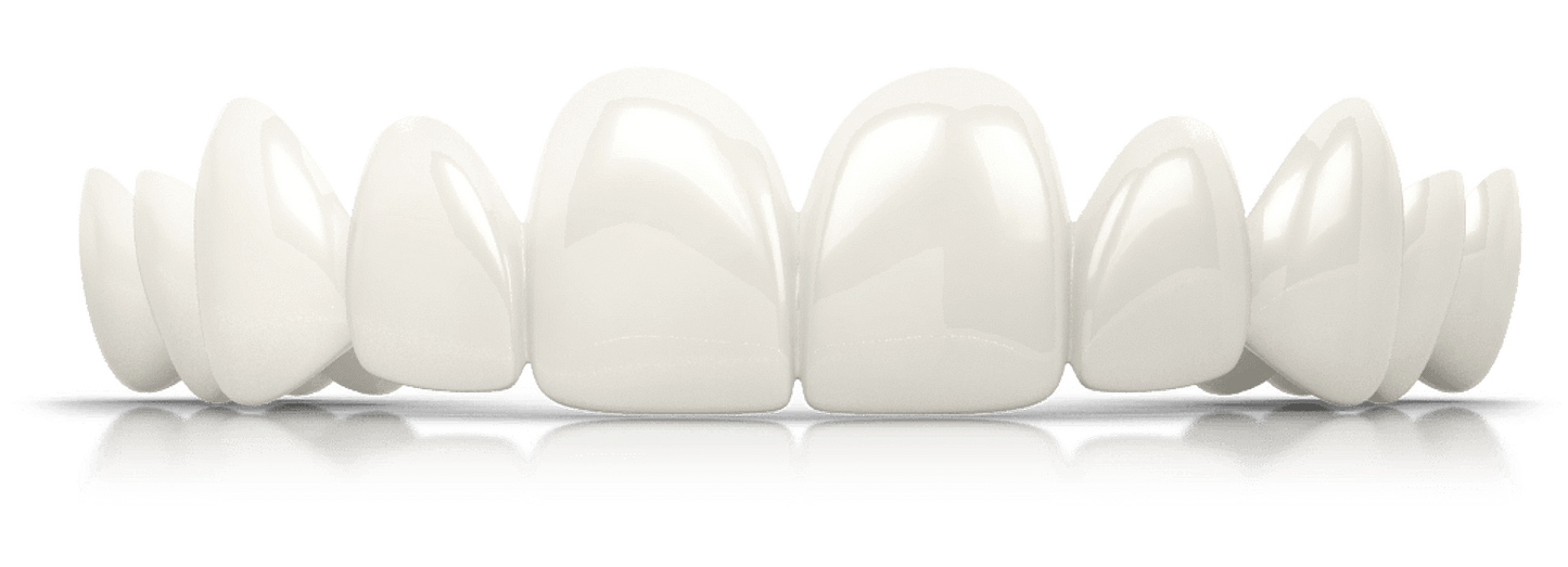 IvorySmile® Clip-On Bundle | 3 + 1 Free Toothpaste