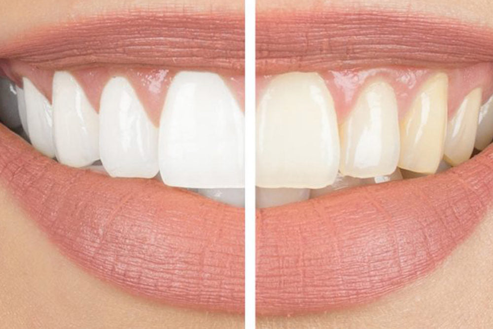IvorySmile Whitening Purple Toothpaste