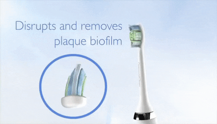 IvorySmile® Sonic Toothbrush