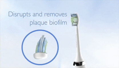 IvorySmile® Sonic Toothbrush