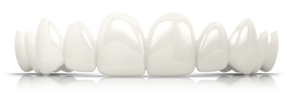 IvorySmile® Clip-On Bundle | 3 + 1 Free Toothpaste